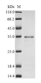 SDS-PAGE (TYK2-1452H).jpg
